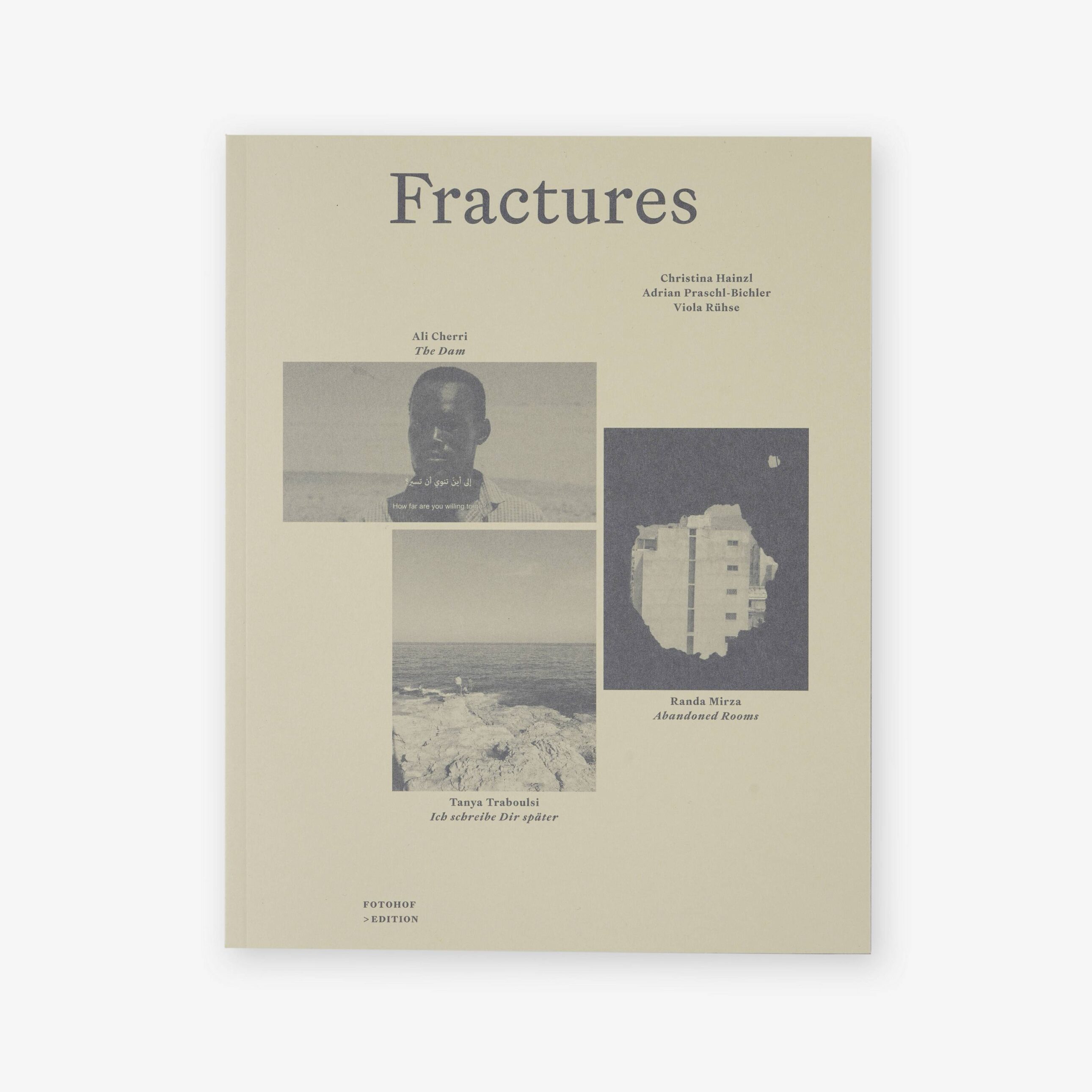 Fractures